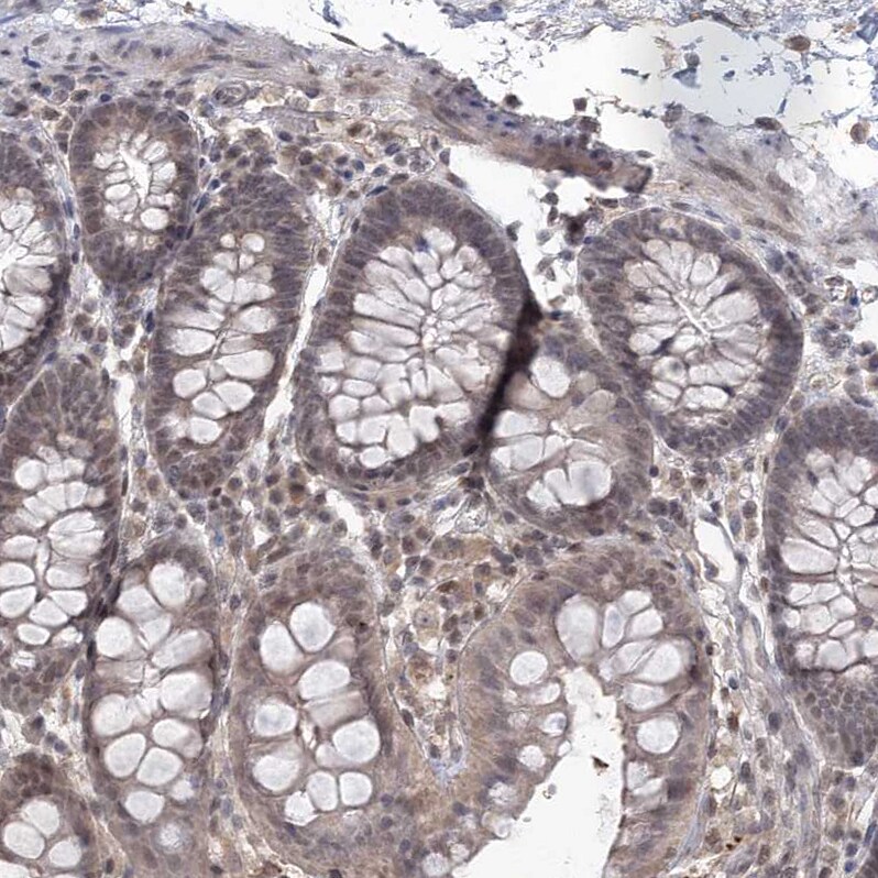 RAP80 Antibody - BSA Free Immunohistochemistry-Paraffin: RAP80 Antibody [NBP1-87157]
