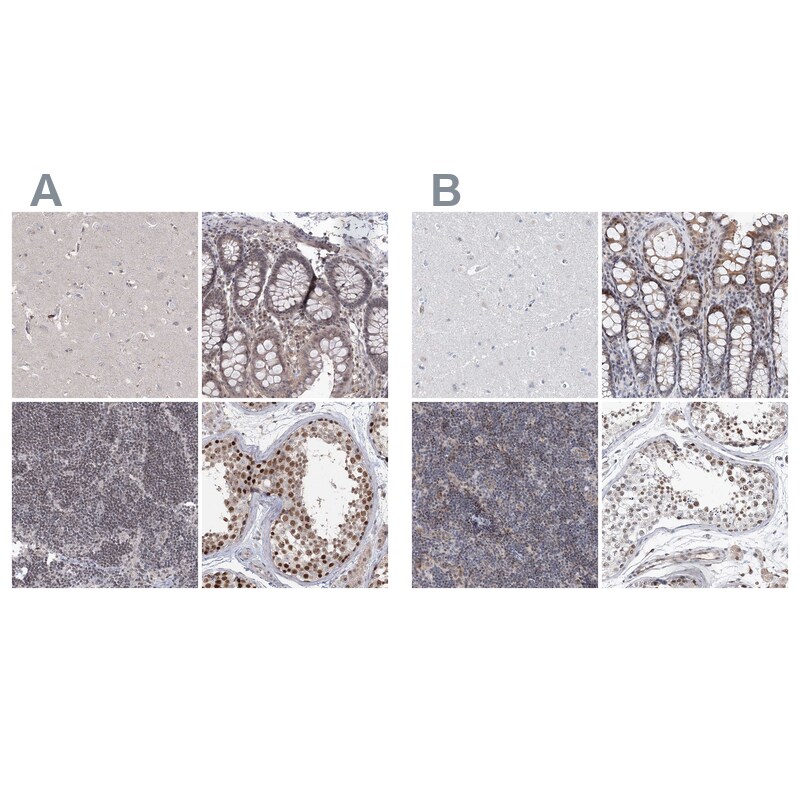 RAP80 Antibody - BSA Free Immunohistochemistry-Paraffin: RAP80 Antibody [NBP1-87157]