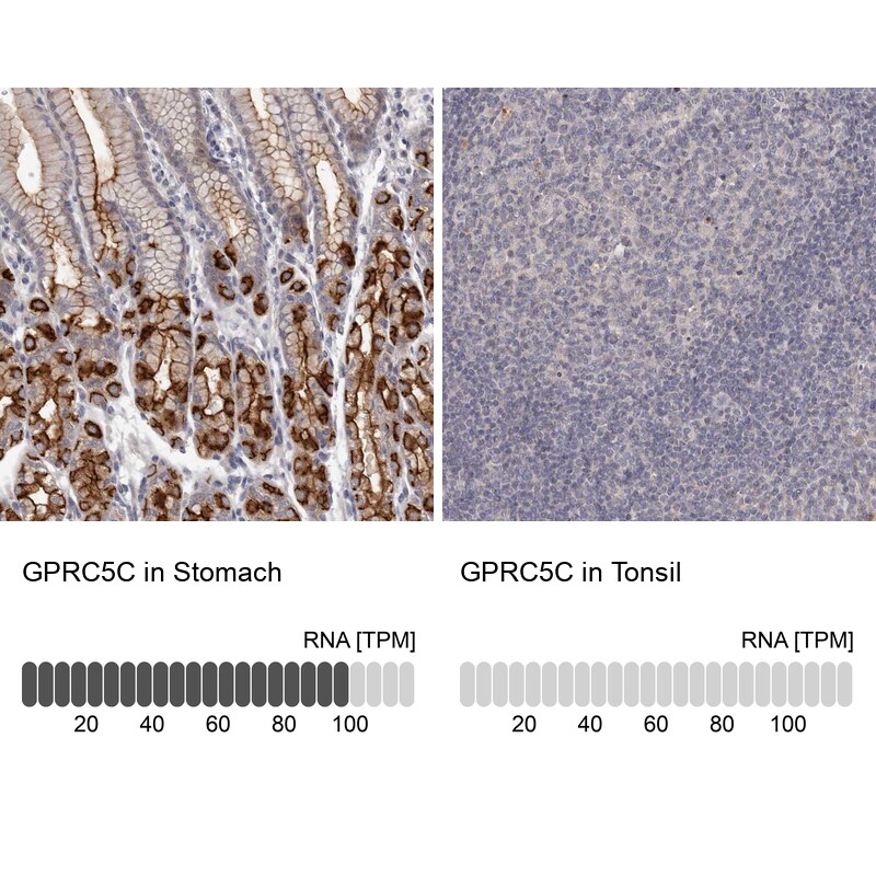 GPRC5C Antibody - BSA Free Immunohistochemistry-Paraffin: GPRC5C Antibody [NBP1-87159]