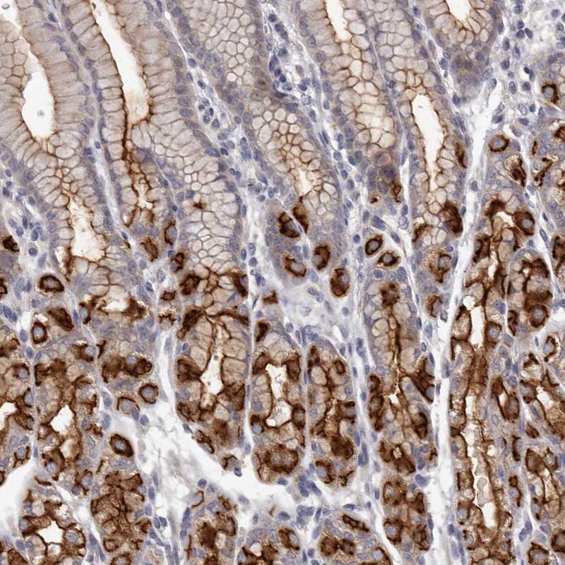 GPRC5C Antibody - BSA Free Immunohistochemistry-Paraffin: GPRC5C Antibody [NBP1-87159]