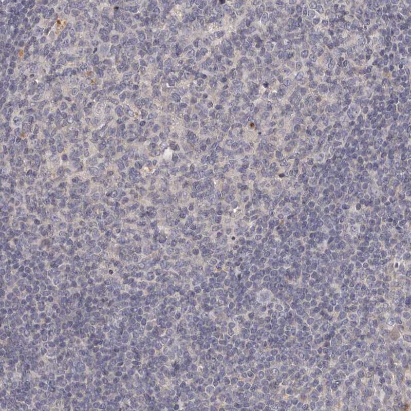 GPRC5C Antibody - BSA Free Immunohistochemistry-Paraffin: GPRC5C Antibody [NBP1-87159]