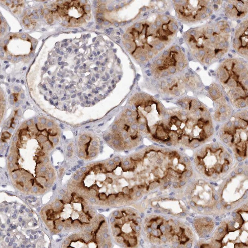GPRC5C Antibody - BSA Free Immunohistochemistry-Paraffin: GPRC5C Antibody [NBP1-87159]