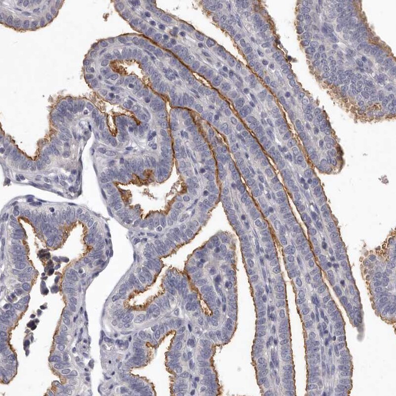 GPRC5C Antibody - BSA Free Immunohistochemistry-Paraffin: GPRC5C Antibody [NBP1-87159]