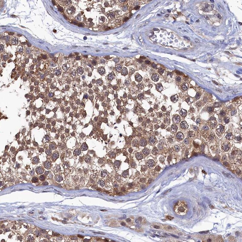 Ribonuclease Inhibitor Antibody - BSA Free Immunohistochemistry-Paraffin: Ribonuclease Inhibitor Antibody [NBP1-87161]
