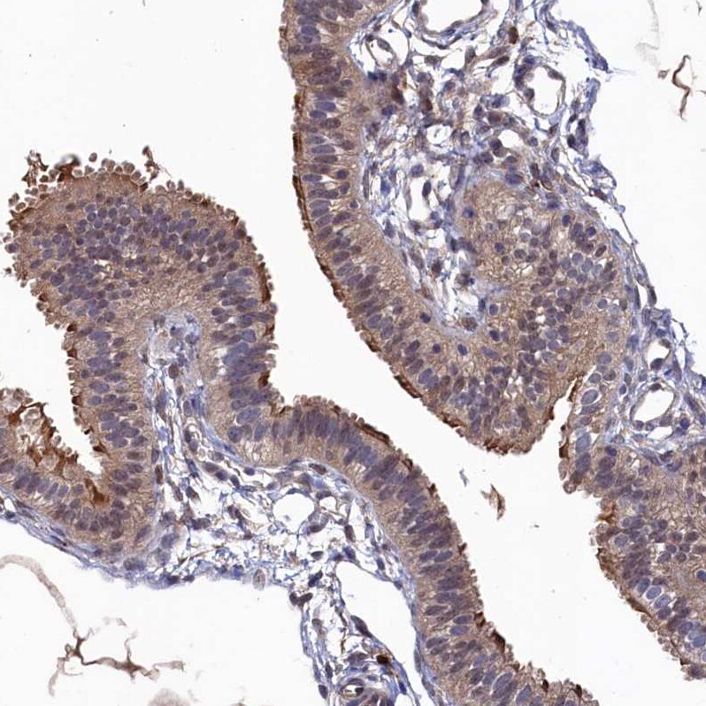 Ribonuclease Inhibitor Antibody - BSA Free Immunohistochemistry-Paraffin: Ribonuclease Inhibitor Antibody [NBP1-87161]