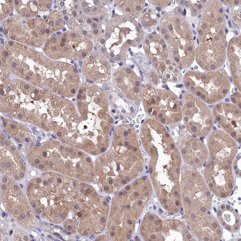 Ribonuclease Inhibitor Antibody - BSA Free Immunohistochemistry-Paraffin: Ribonuclease Inhibitor Antibody [NBP1-87161]