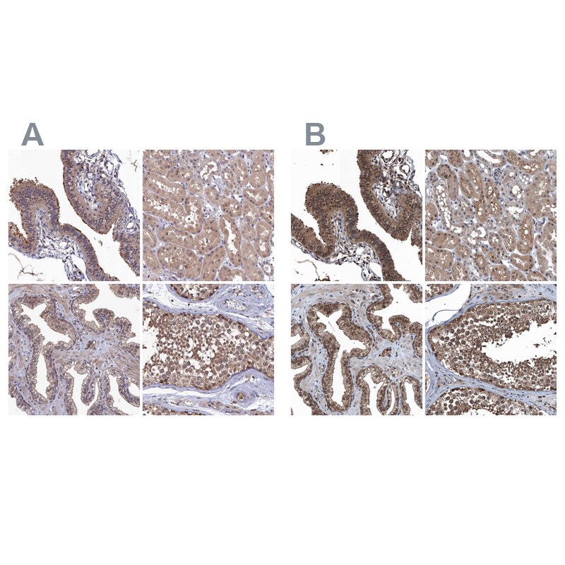 Ribonuclease Inhibitor Antibody - BSA Free Immunohistochemistry-Paraffin: Ribonuclease Inhibitor Antibody [NBP1-87161]