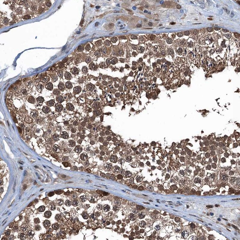 Ribonuclease Inhibitor Antibody - BSA Free Immunohistochemistry-Paraffin: Ribonuclease Inhibitor Antibody [NBP1-87162]