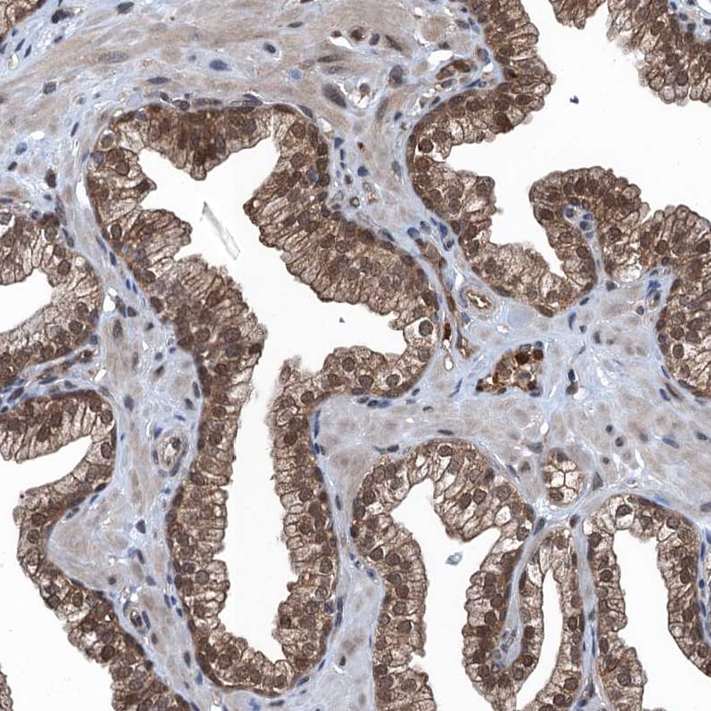Ribonuclease Inhibitor Antibody - BSA Free Immunohistochemistry-Paraffin: Ribonuclease Inhibitor Antibody [NBP1-87162]