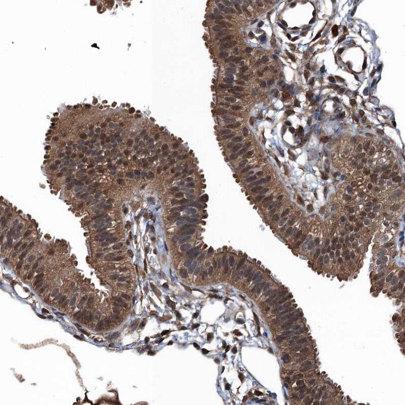 Ribonuclease Inhibitor Antibody - BSA Free Immunohistochemistry-Paraffin: Ribonuclease Inhibitor Antibody [NBP1-87162]