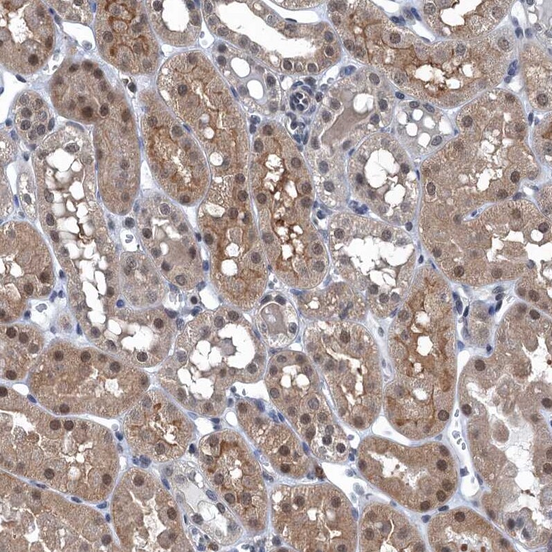 Ribonuclease Inhibitor Antibody - BSA Free Immunohistochemistry-Paraffin: Ribonuclease Inhibitor Antibody [NBP1-87162]