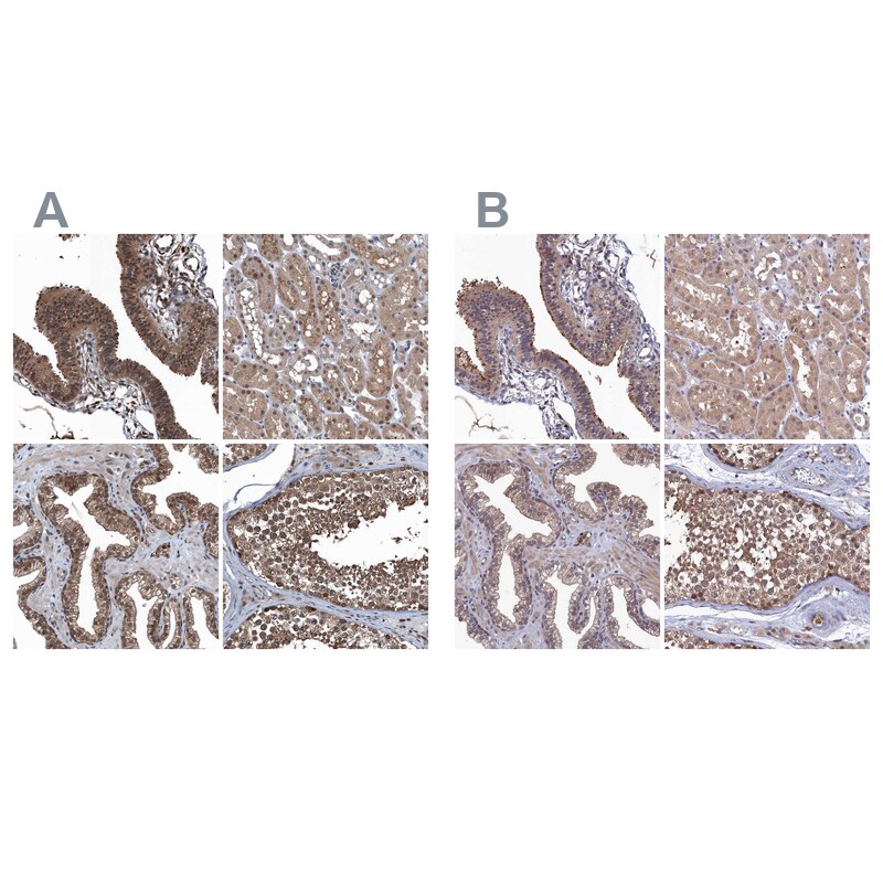 Ribonuclease Inhibitor Antibody - BSA Free Immunohistochemistry-Paraffin: Ribonuclease Inhibitor Antibody [NBP1-87162]
