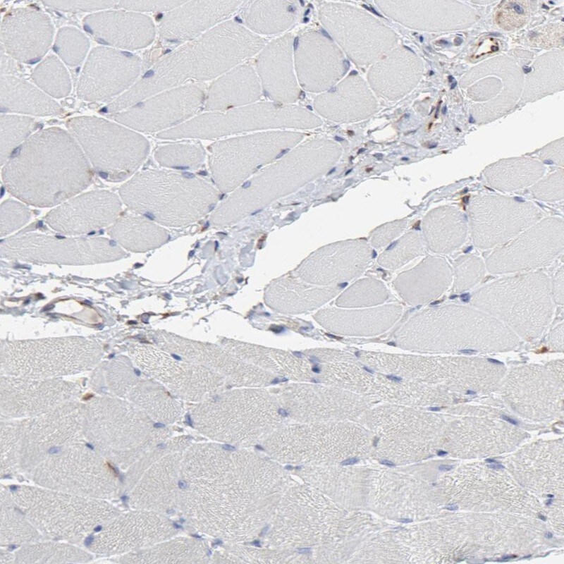 RAB9A Antibody - BSA Free Immunohistochemistry-Paraffin: RAB9A Antibody [NBP1-87172]