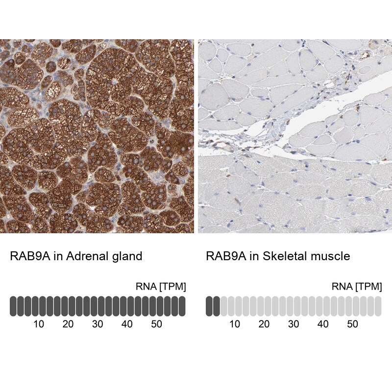 RAB9A Antibody - BSA Free Immunohistochemistry-Paraffin: RAB9A Antibody [NBP1-87172]