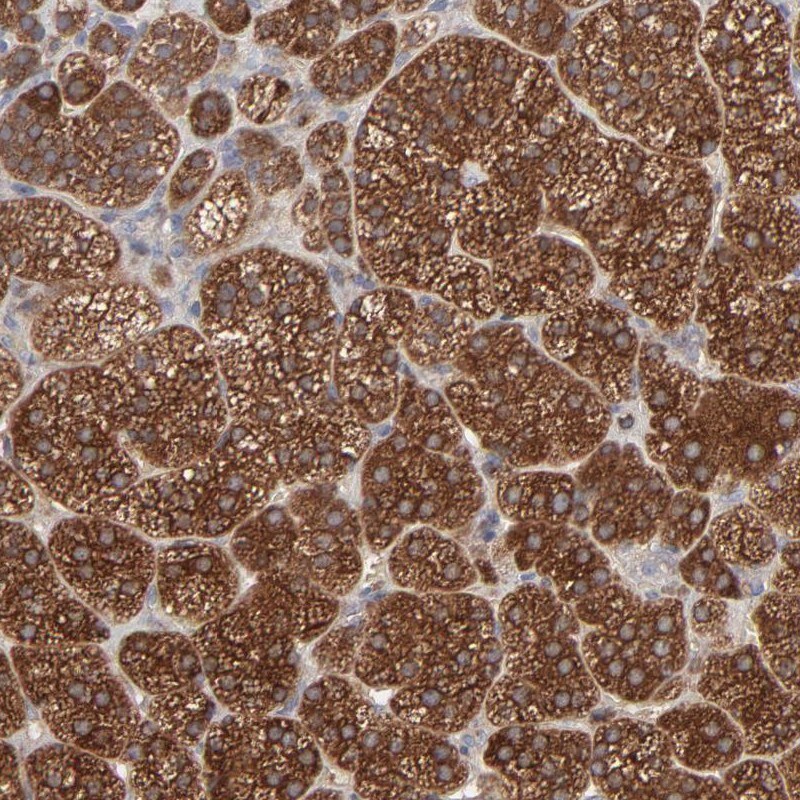 RAB9A Antibody - BSA Free Immunohistochemistry-Paraffin: RAB9A Antibody [NBP1-87172]