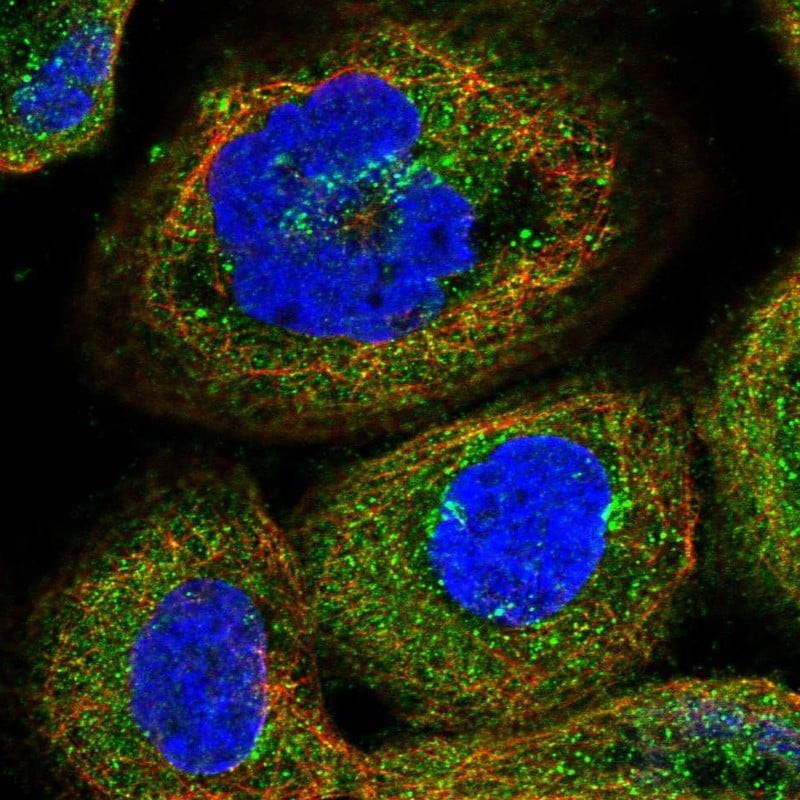 PEX5 Antibody - BSA Free Immunocytochemistry/ Immunofluorescence: PEX5 Antibody [NBP1-87185]