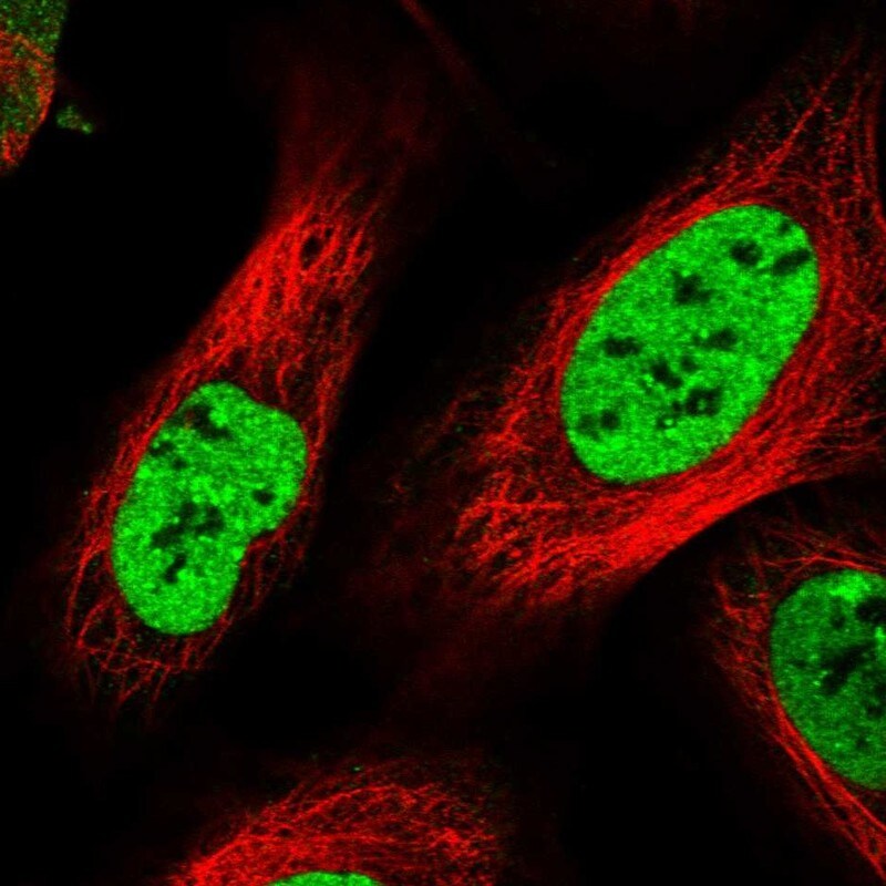 DBC1/p30 Antibody Immunocytochemistry/ Immunofluorescence: DBC1/p30 Antibody [NBP1-85305]