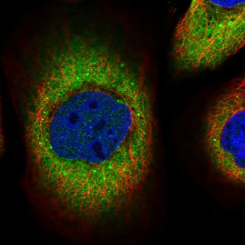 PSPHL Antibody Immunocytochemistry/ Immunofluorescence: PSPHL Antibody [NBP1-87202]
