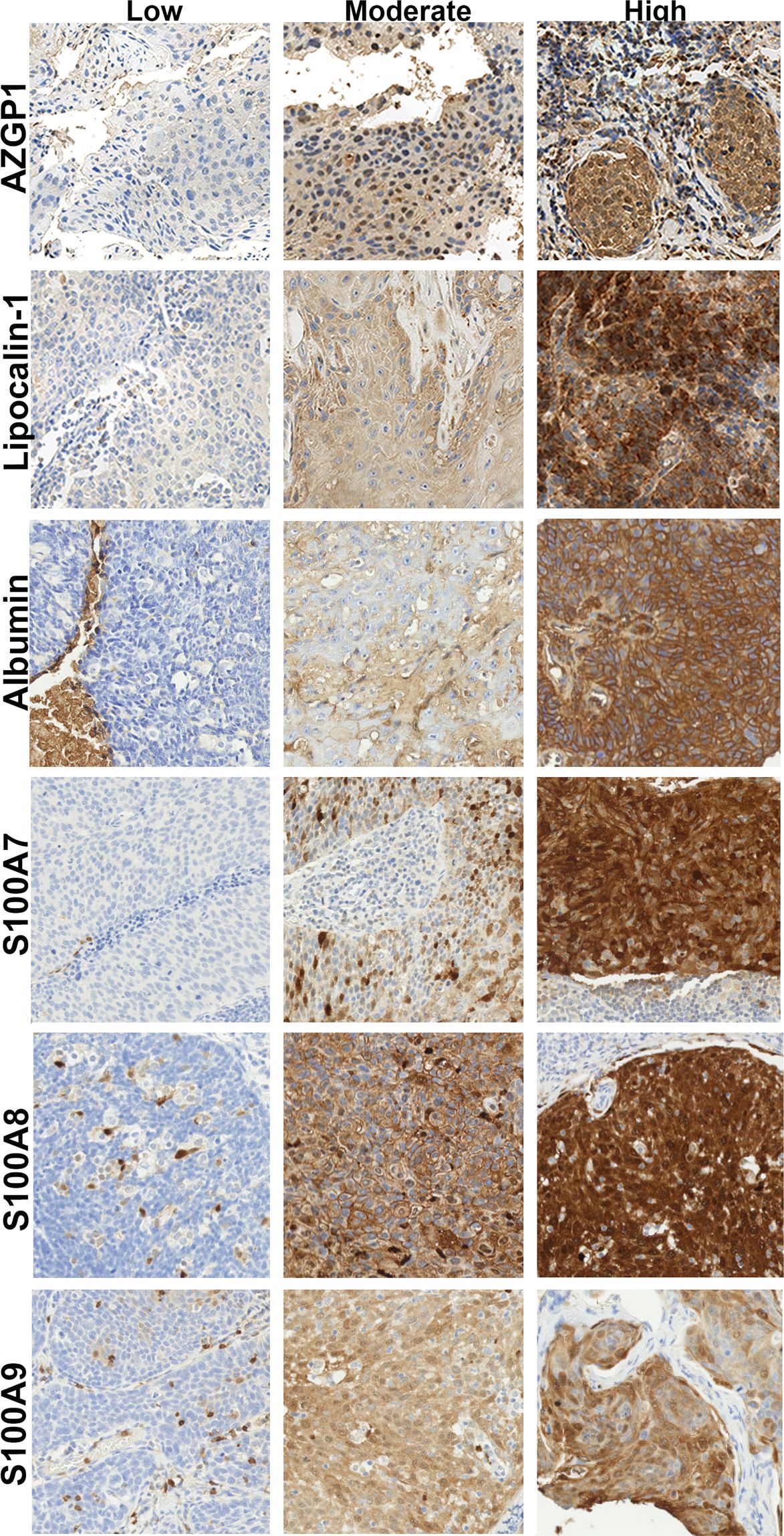 S100A7/Psoriasin Antibody