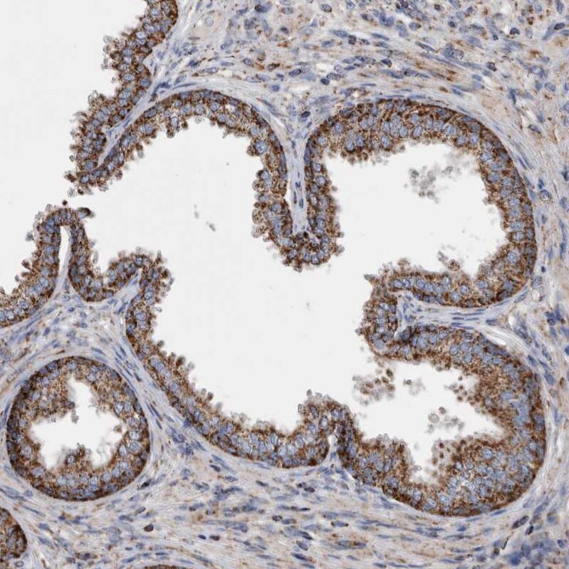 WFDC1 Antibody - BSA Free Immunohistochemistry: WFDC1 Antibody - BSA Free [NBP1-87207]