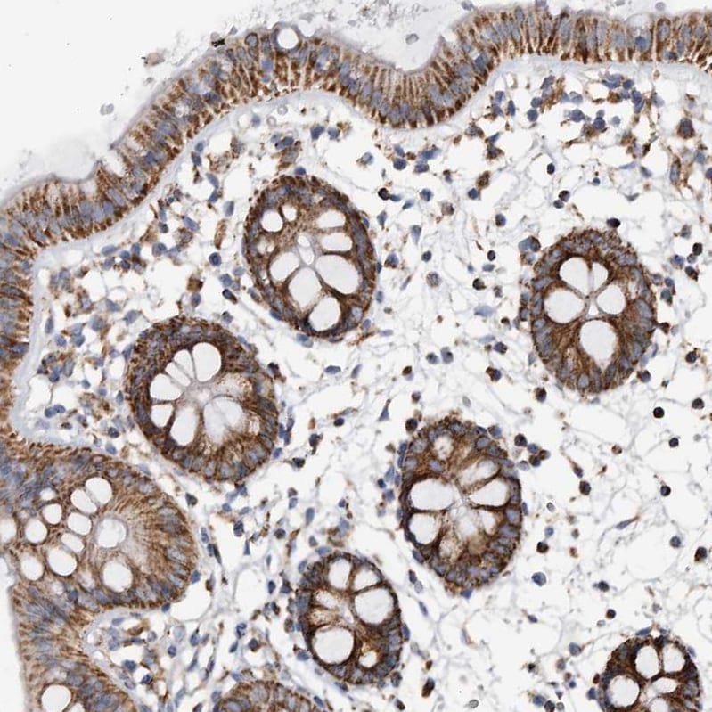 WFDC1 Antibody - BSA Free Immunohistochemistry: WFDC1 Antibody - BSA Free [NBP1-87207]