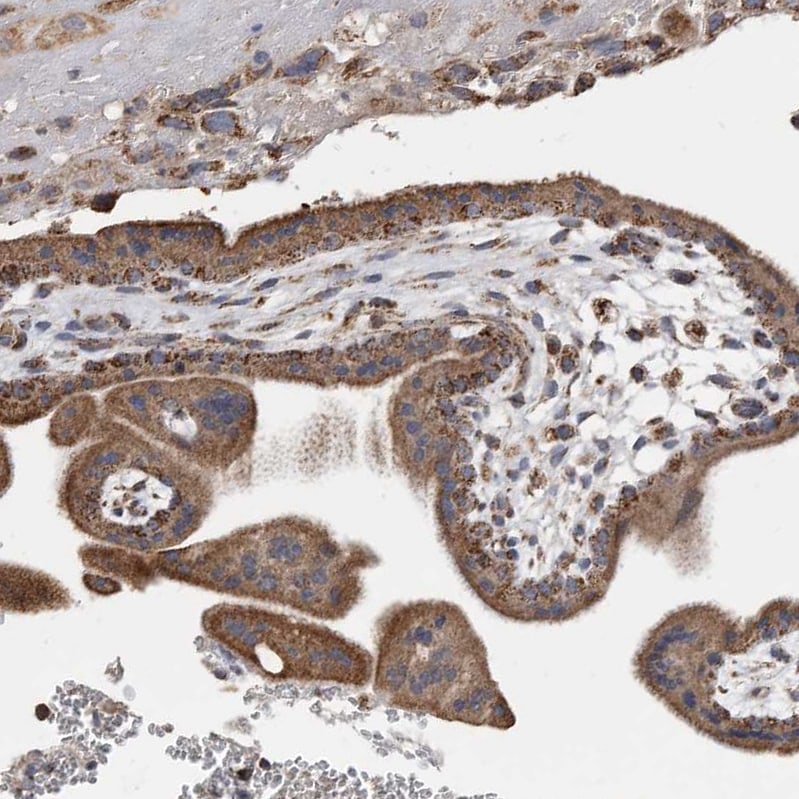 WFDC1 Antibody - BSA Free Immunohistochemistry: WFDC1 Antibody - BSA Free [NBP1-87207]