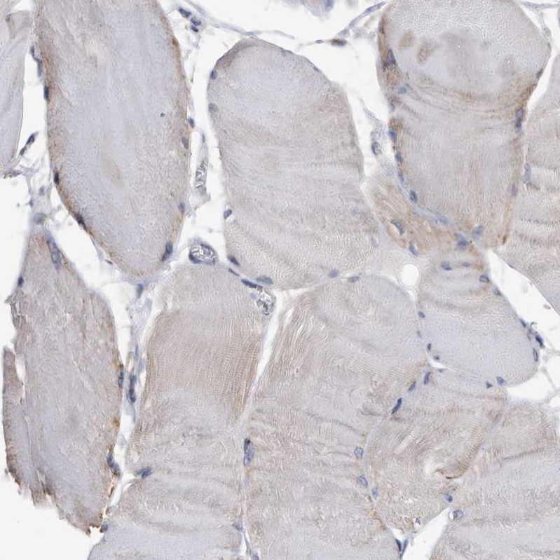 WFDC1 Antibody - BSA Free Immunohistochemistry: WFDC1 Antibody - BSA Free [NBP1-87207]