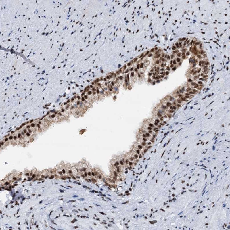 DDX23 Antibody - BSA Free Immunohistochemistry-Paraffin: DDX23 Antibody [NBP1-87213]