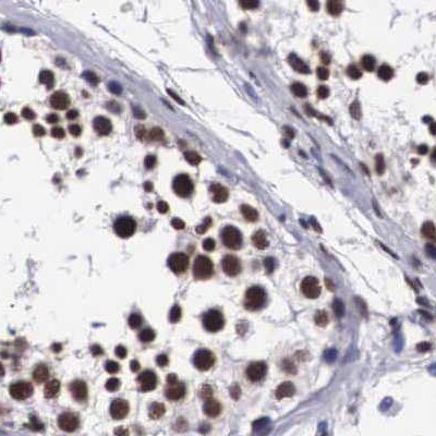SF3A1 Antibody - BSA Free Immunohistochemistry-Paraffin: SF3A1 Antibody [NBP1-87214]