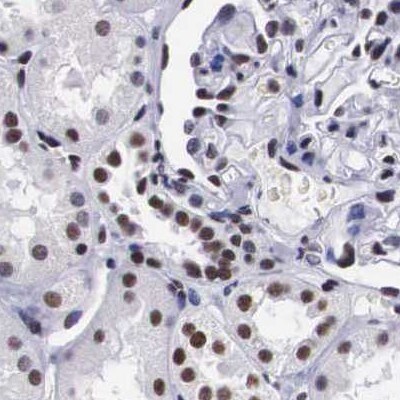 SF3A1 Antibody - BSA Free Immunohistochemistry-Paraffin: SF3A1 Antibody [NBP1-87214]