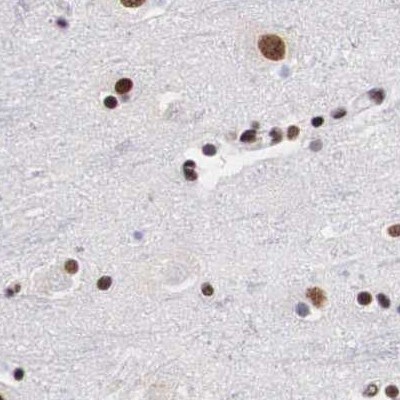SF3A1 Antibody - BSA Free Immunohistochemistry-Paraffin: SF3A1 Antibody [NBP1-87214]
