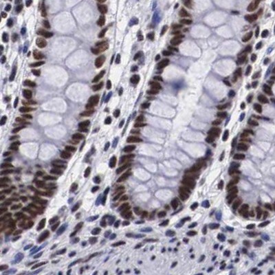SF3A1 Antibody - BSA Free Immunohistochemistry-Paraffin: SF3A1 Antibody [NBP1-87214]