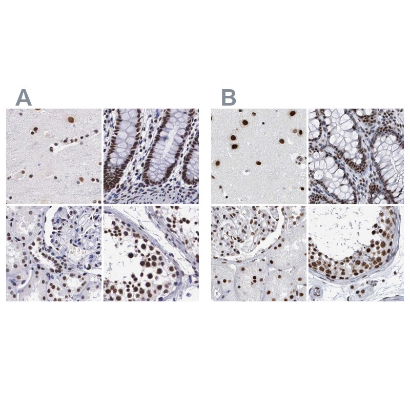 SF3A1 Antibody - BSA Free Immunohistochemistry-Paraffin: SF3A1 Antibody [NBP1-87214]