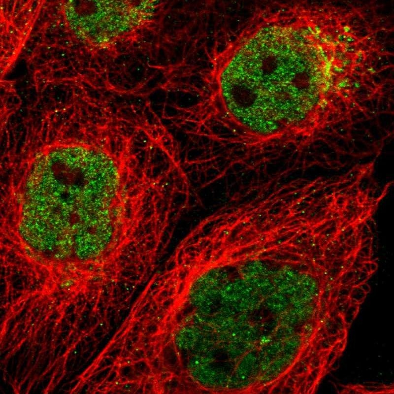 PRKCBP1 Antibody - BSA Free Immunocytochemistry/ Immunofluorescence: PRKCBP1 Antibody [NBP1-87227]