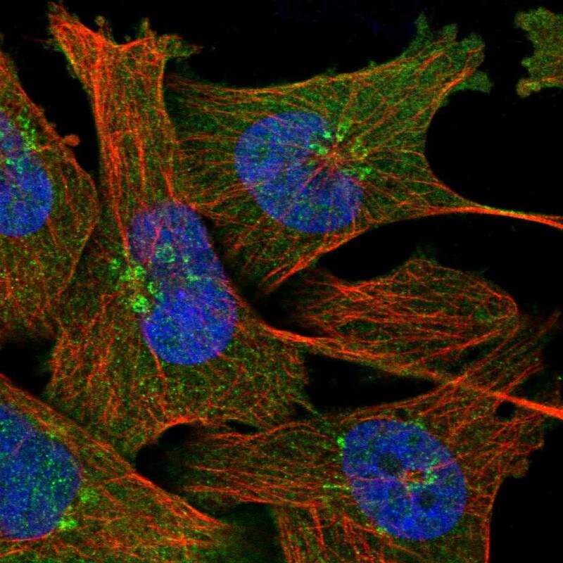 NAPRT1 Antibody - BSA Free Immunocytochemistry/ Immunofluorescence: NAPRT1 Antibody [NBP1-87243]