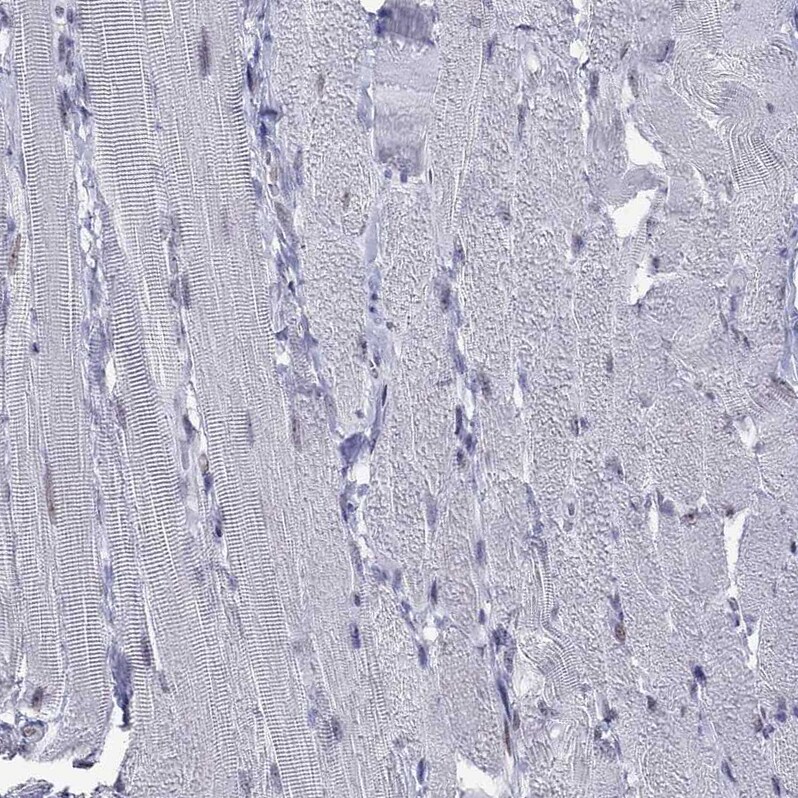 PP2C gamma/PPM1G Antibody - BSA Free Immunohistochemistry-Paraffin: PP2C gamma/PPM1G Antibody [NBP1-87246]