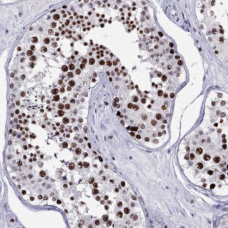 PP2C gamma/PPM1G Antibody - BSA Free Immunohistochemistry-Paraffin: PP2C gamma/PPM1G Antibody [NBP1-87246]