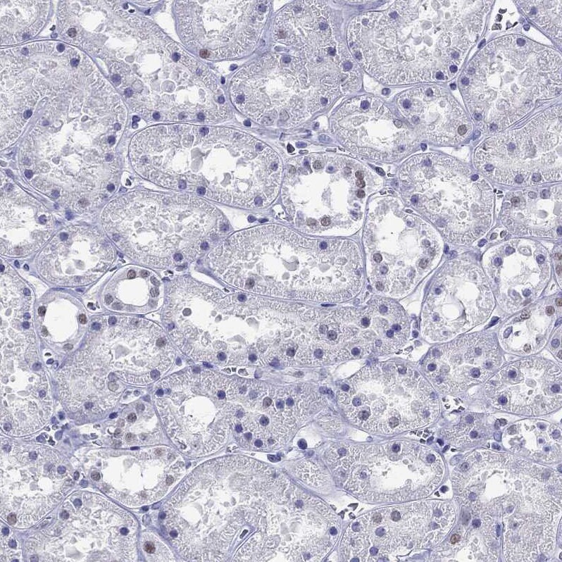 PP2C gamma/PPM1G Antibody - BSA Free Immunohistochemistry-Paraffin: PP2C gamma/PPM1G Antibody [NBP1-87246]