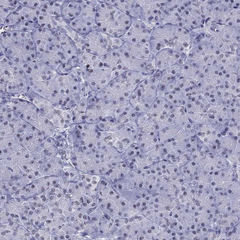 PP2C gamma/PPM1G Antibody - BSA Free Immunohistochemistry-Paraffin: PP2C gamma/PPM1G Antibody [NBP1-87246]