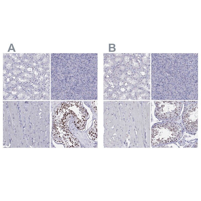PP2C gamma/PPM1G Antibody - BSA Free Immunohistochemistry-Paraffin: PP2C gamma/PPM1G Antibody [NBP1-87246]