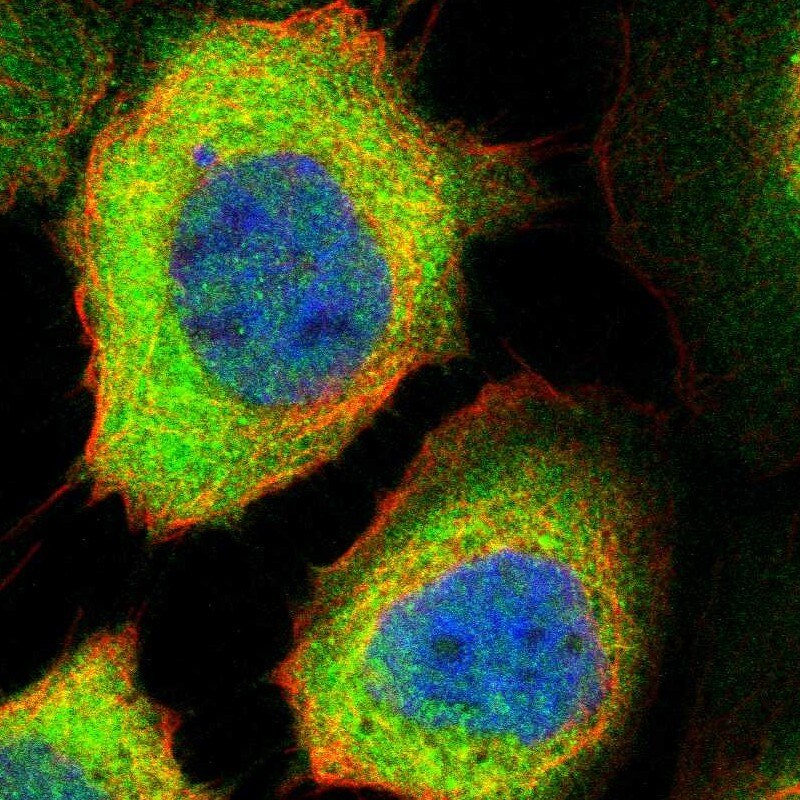 PP2C epsilon/PPM1L Antibody - BSA Free Immunocytochemistry/ Immunofluorescence: PP2C epsilon/PPM1L Antibody [NBP1-87247]