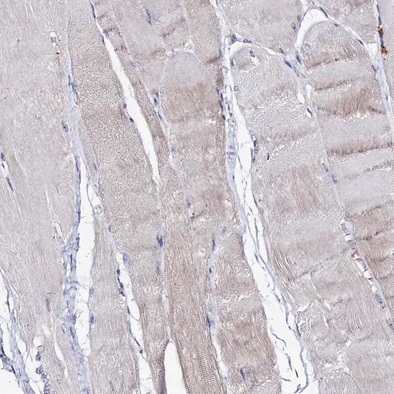 ARFIP2 Antibody - BSA Free Immunohistochemistry-Paraffin: ARFIP2 Antibody [NBP1-87255]