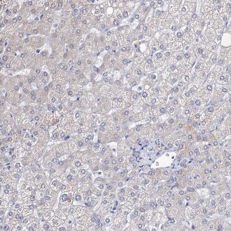 ARFIP2 Antibody - BSA Free Immunohistochemistry-Paraffin: ARFIP2 Antibody [NBP1-87255]