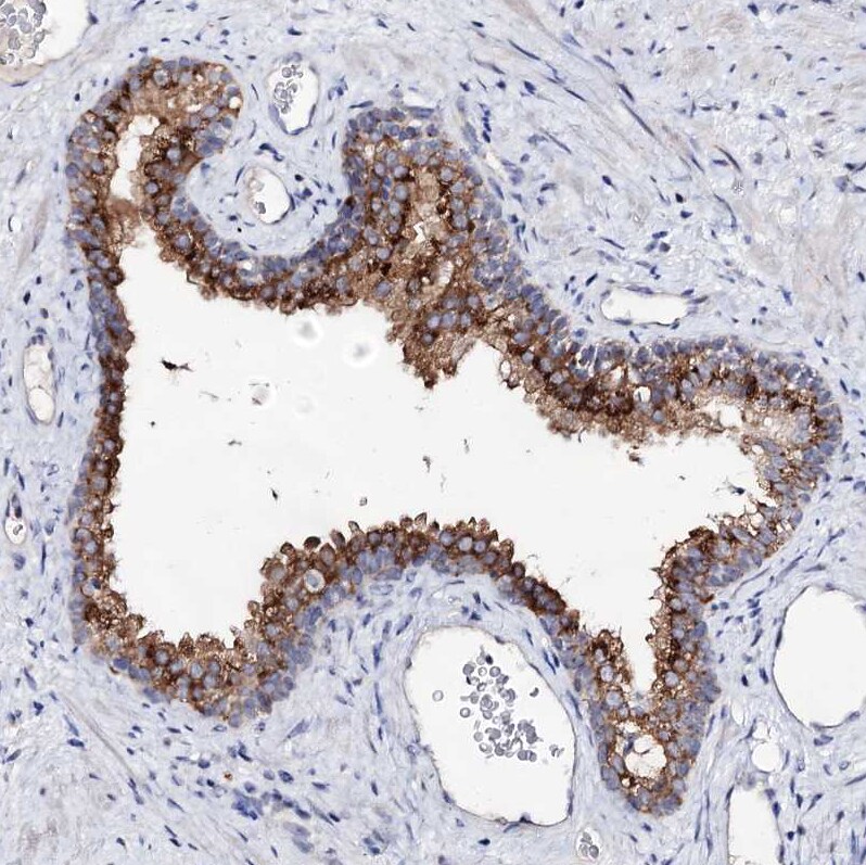 ARFIP2 Antibody - BSA Free Immunohistochemistry-Paraffin: ARFIP2 Antibody [NBP1-87255]