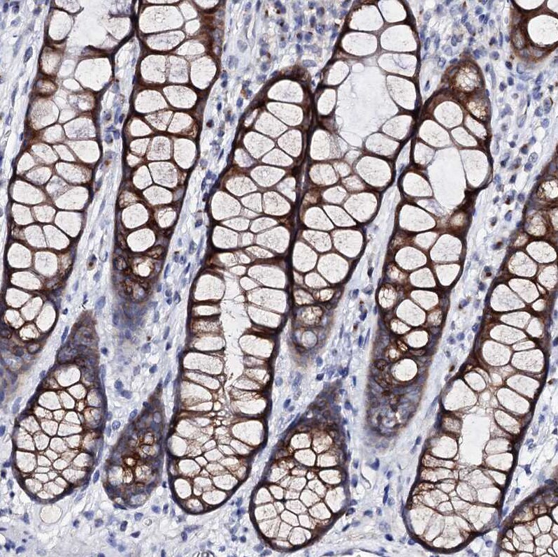 ARFIP2 Antibody - BSA Free Immunohistochemistry-Paraffin: ARFIP2 Antibody [NBP1-87255]