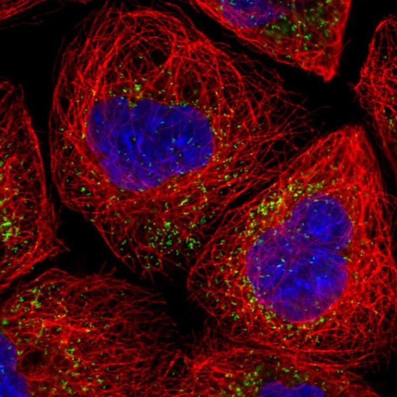 PMP70 Antibody - BSA Free Immunocytochemistry/ Immunofluorescence: PMP70 Antibody [NBP1-87258]