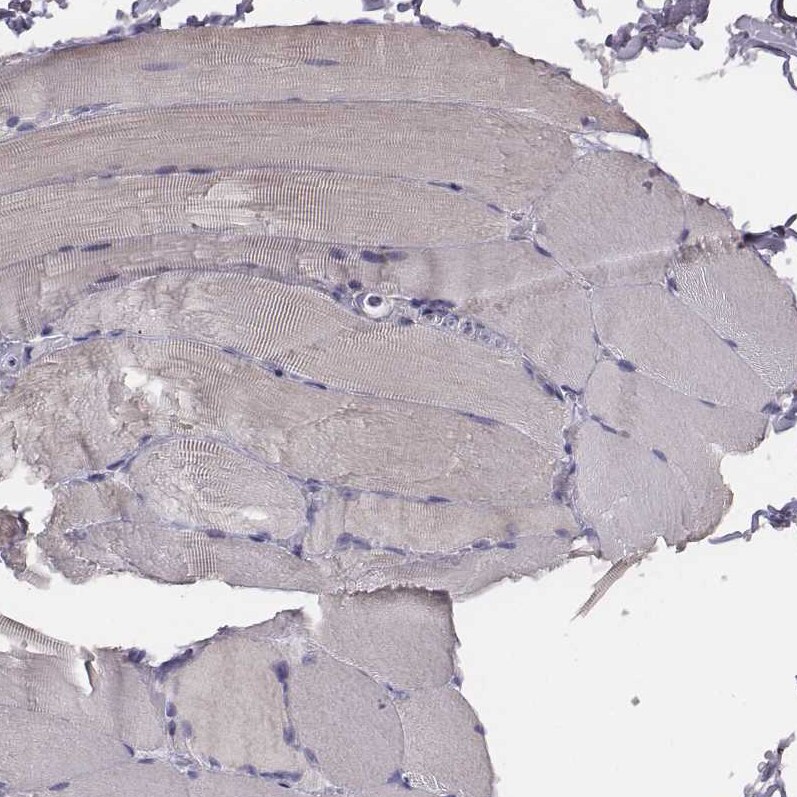 PKC zeta Antibody - BSA Free Immunohistochemistry-Paraffin: PKC zeta Antibody [NBP1-87270]