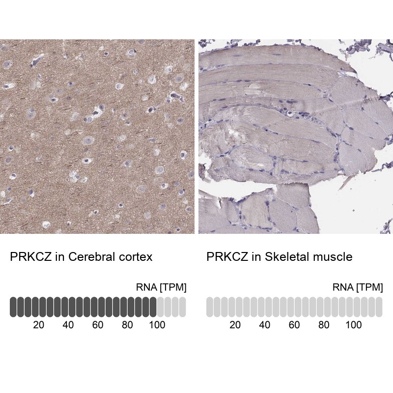 PKC zeta Antibody - BSA Free Immunohistochemistry-Paraffin: PKC zeta Antibody [NBP1-87270]