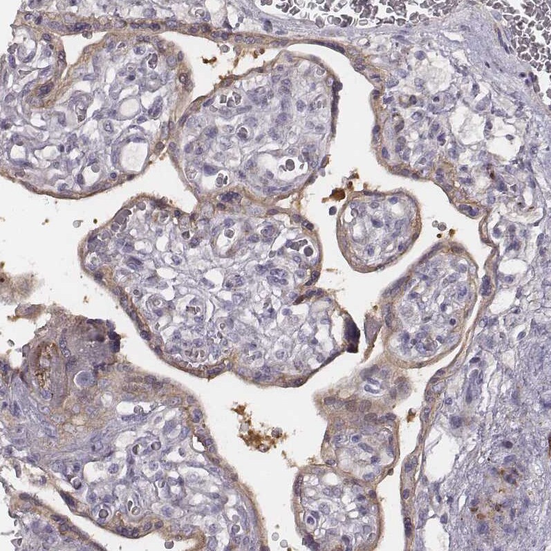 PKC zeta Antibody - BSA Free Immunohistochemistry-Paraffin: PKC zeta Antibody [NBP1-87270]