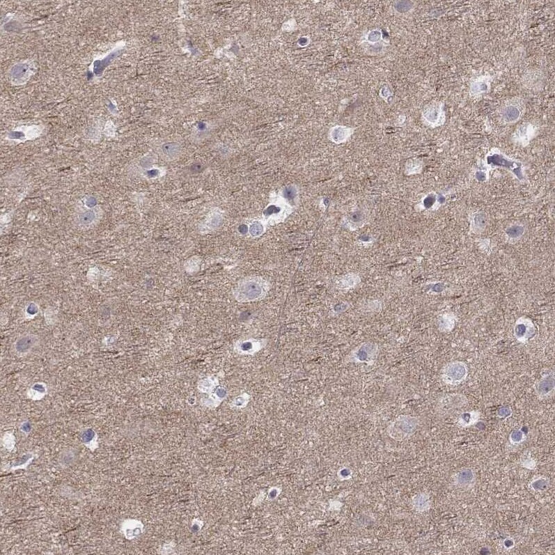 PKC zeta Antibody - BSA Free Immunohistochemistry-Paraffin: PKC zeta Antibody [NBP1-87270]